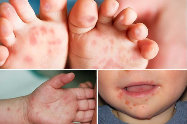 Ảnh minh họa: Sức khỏe đời sống