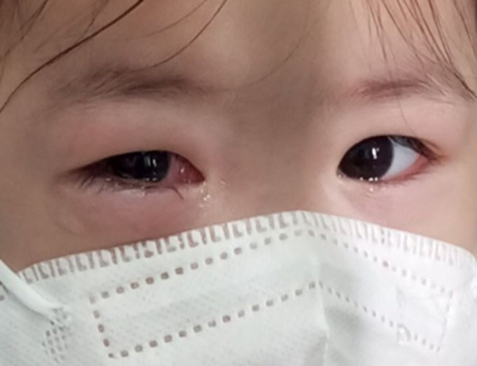Ảnh: Bệnh viện Mắt Hà Nội 2 