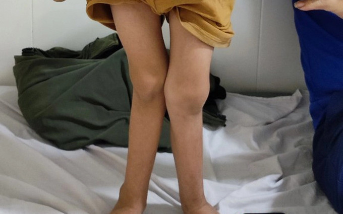 lo