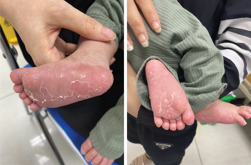 Chuyên gia khuyến cáo cách phòng bệnh lây truyền qua đường tình dục