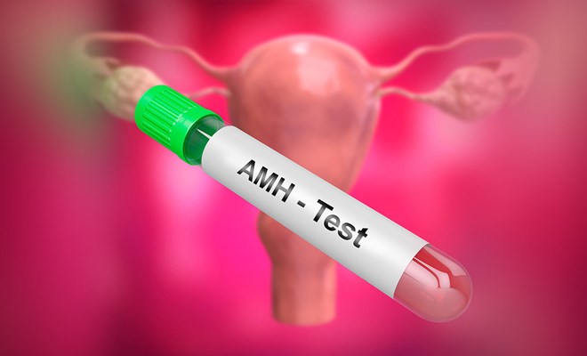 Ý nghĩa của xét nghiệm AMH?