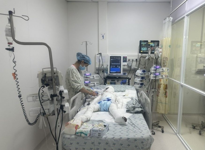 Bệnh nhi bị phỏng đang được điều trị tích cực tại Bệnh viện Nhi đồng thành phố (Ảnh: Bệnh viện Nhi đồng thành phố)