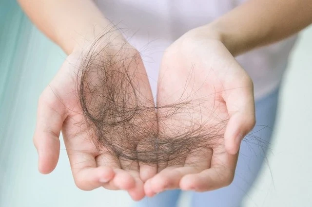 Rụng tóc nhiều là một trong những triệu chứng chính khi nghi ngờ thiếu kẽm