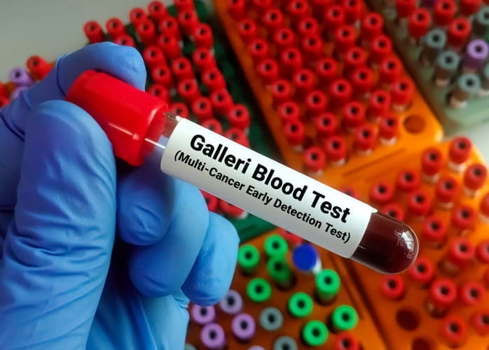 multi-cancer-early-detection-t-6625-2566-1761018049
