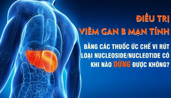 Điều trị viêm gan B mạn tính bằng các thuốc ức chế vi rút loại nucleoside/nucleotide có khi nào dừng được không?