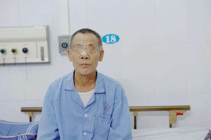 Rò dịch não tủy qua đường mũi: Triệu chứng khó nhận biết nhưng biến chứng nghiêm trọng