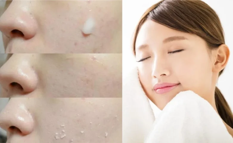 6 mẹo thu nhỏ lỗ chân lông trên da mặt
