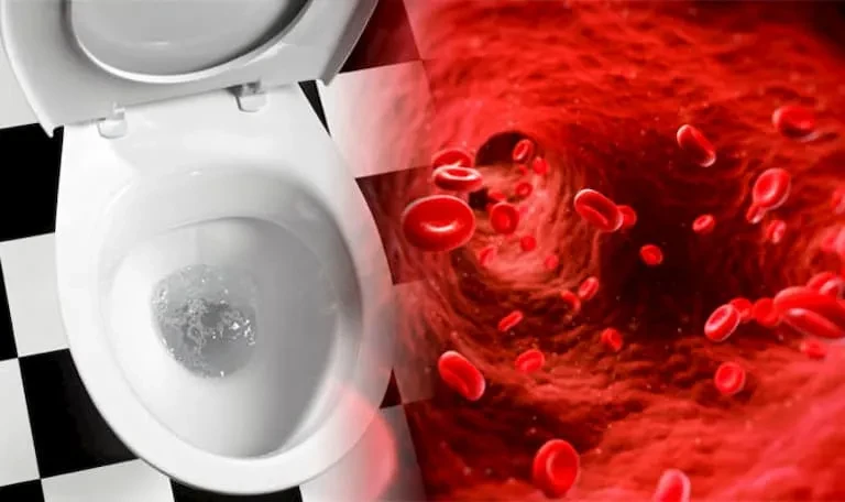 Nguyên nhân và cách chữa trị tiểu ra máu