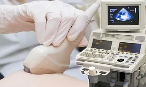 Siêu âm đàn hồi mô tuyến vú: Những thông tin cần biết