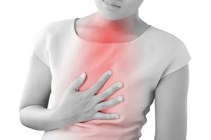 8 biện pháp khắc phục tại nhà để điều trị trào ngược dạ dày