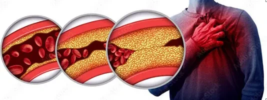 Những thói quen ăn uống giúp bảo vệ sức khỏe tim mạch