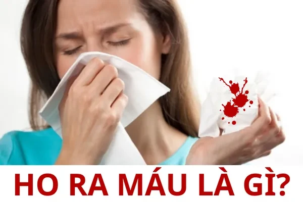 Thông tin hữu ích cho người có biểu hiện ho ra máu