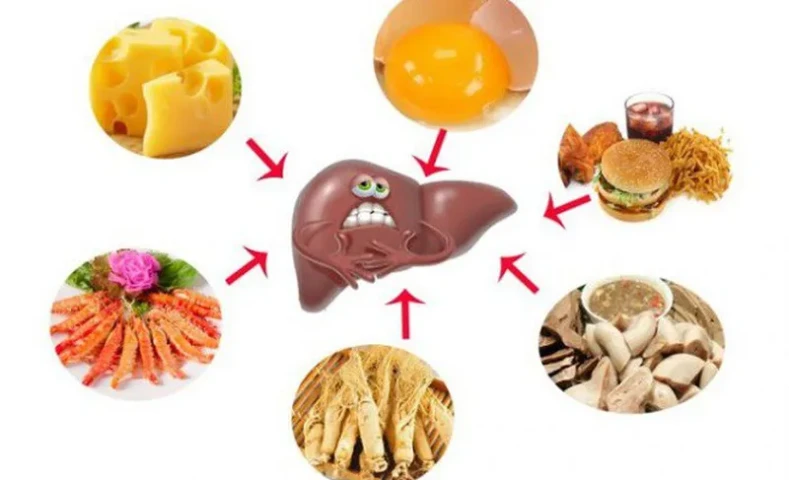 Chuyên gia khuyến cáo dinh dưỡng phù hợp cho người bị xơ gan