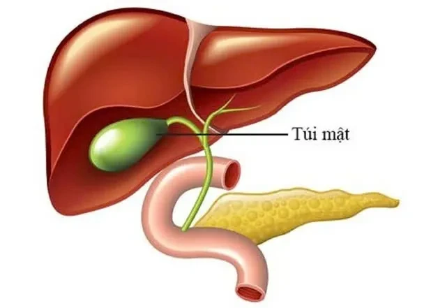 Những điều cần biết về bệnh Polyp túi mật