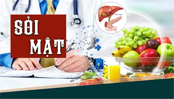 Sỏi mật