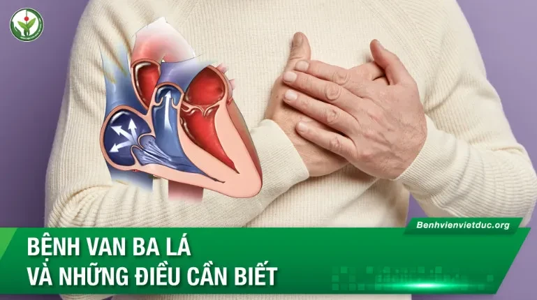 Bệnh van ba lá và những điều cần biết
