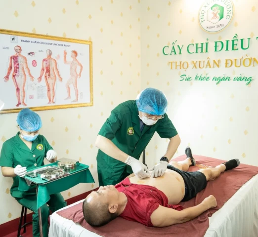 Thế mạnh của châm cứu, cấy chỉ điều trị đau nửa đầu