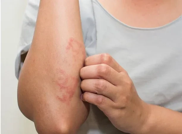 Cẩn thận bệnh do nhiễm ký sinh trùng nguy hiểm