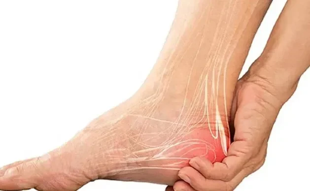 Nguyên nhân gây ra tình trạng viêm cân gan bàn chân