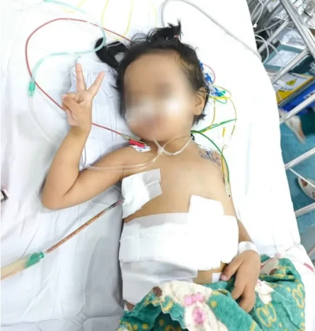 Ghép gan thành công cho bé gái 3 tuổi mắc hội chứng Budd Chiari hiếm gặp