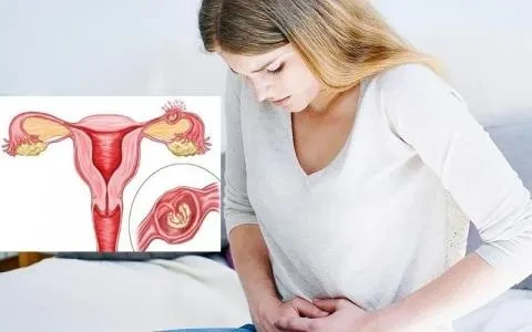 Mang thai ngoài tử cung – những điều cần biết