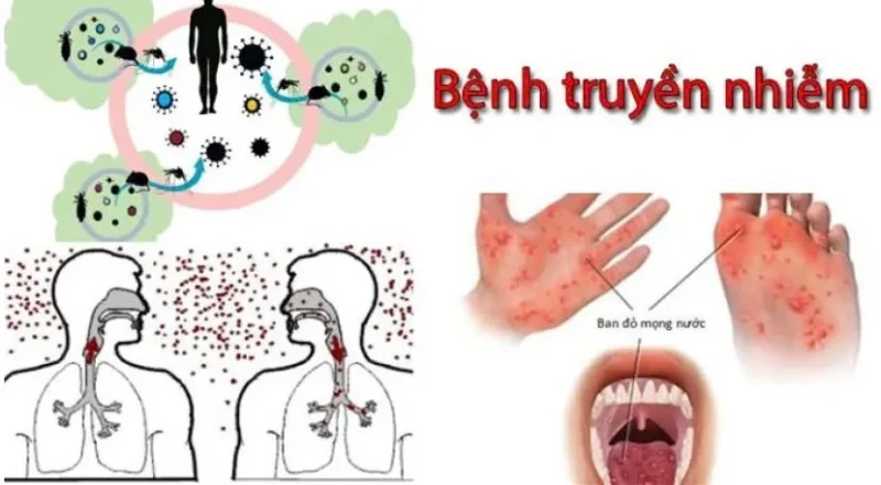 Hà Nội kiện toàn Ban Chỉ đạo phòng, chống dịch bệnh ở người