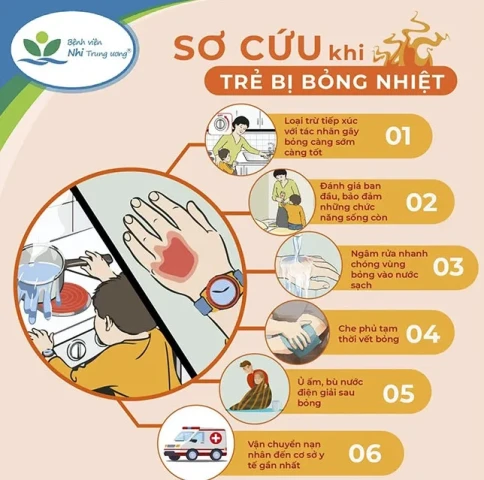 Cách sơ cứu và phòng tránh bỏng ở trẻ em