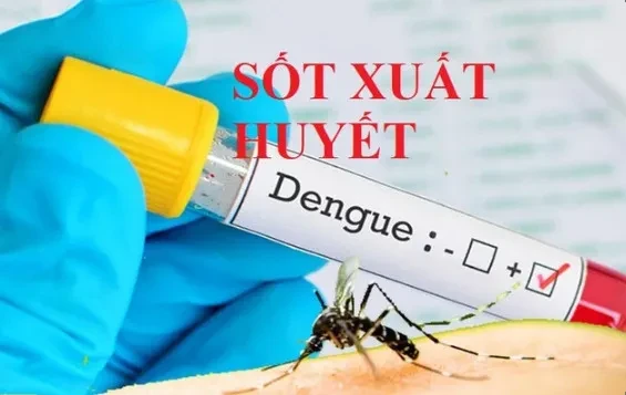 Hà Nội ghi nhận thêm tuýp virus Dengue gây bệnh sốt xuất huyết