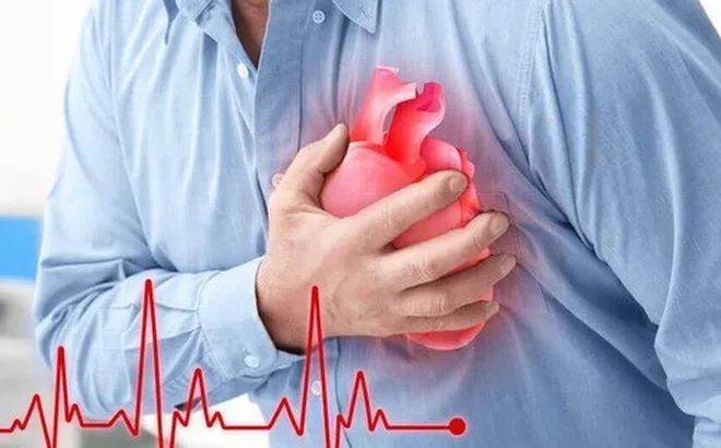 Đột quỵ xảy ra khi nào ?
