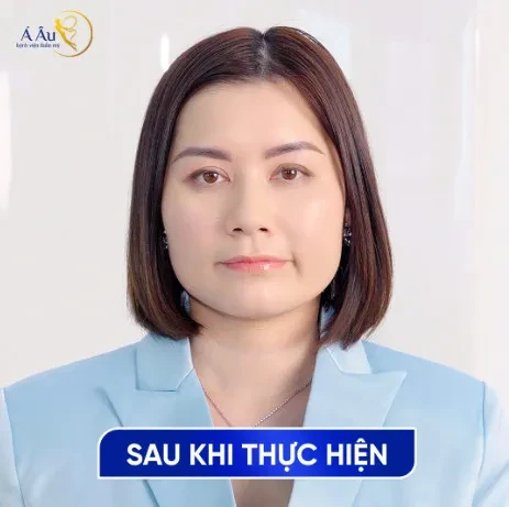 Doanh nhân Thủy Tiên được gây chú ý nhờ ngoại hình trẻ đẹp sau khi căng da chỉ vàng 24K