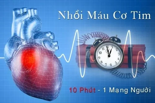 Cảnh báo nhồi máu cơ tim cấp ở người trẻ tuổi