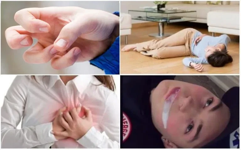 Bộ não và động kinh