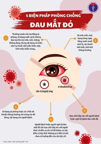 Infographic: 5 biện pháp phòng chống bệnh đau mắt đỏ