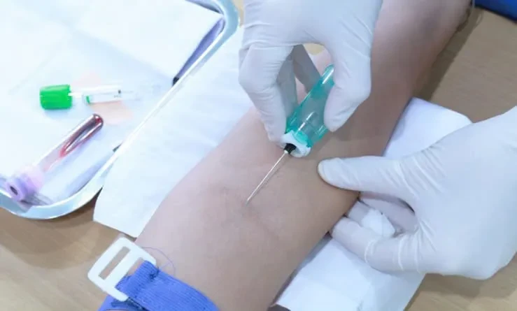 Những xét nghiệm nào không cần nhịn ăn?
