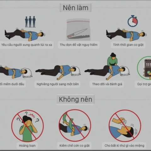 Cần làm gì để phòng bệnh động kinh