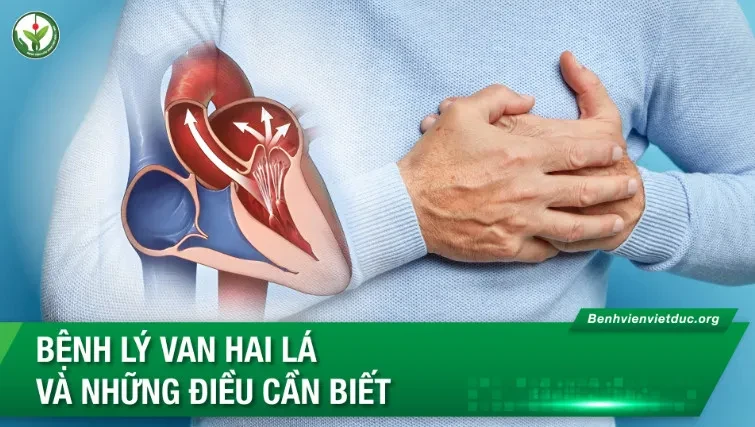 Bệnh lý van hai lá và những điều cần biết