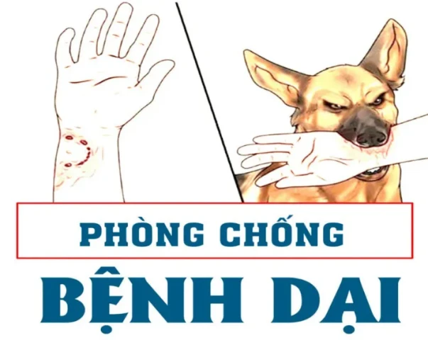 Phòng chống bệnh Dại