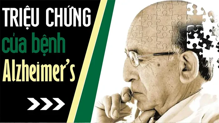 Triệu chứng của bệnh Alzheimer’s
