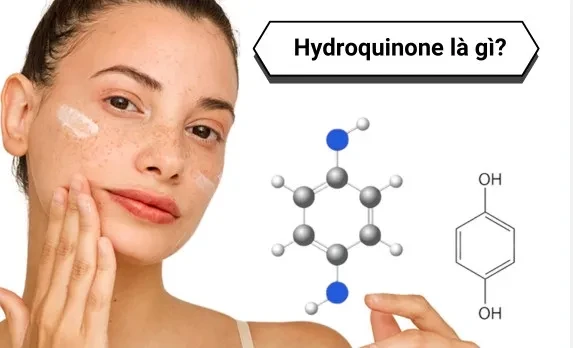 Sử dụng Hydroquinone thế nào để có làn da đẹp?