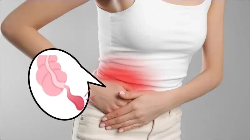 Triệu chứng của viêm ruột thừa như thế nào?