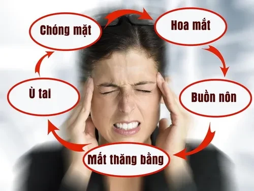 Y học cổ truyền điều trị rối loạn tiền đình nên hay không?
