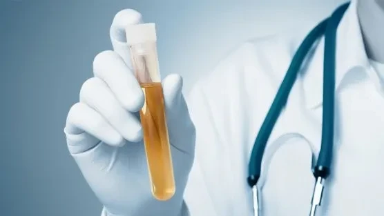 Xét nghiệm nước tiểu và những điều cần lưu ý
