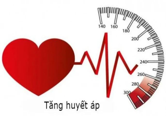 Những quan niệm sai lầm về bệnh tăng huyết áp