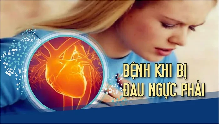 Bệnh khi bị đau ngực phải