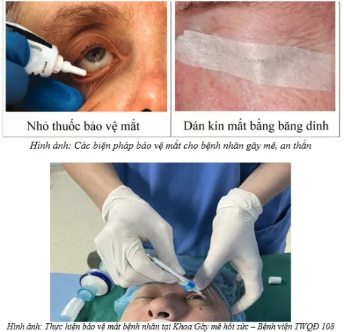 Bảo vệ mắt cho bệnh nhân trong gây mê và hồi sức tích cực