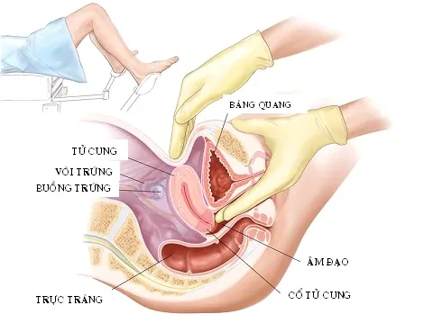Phòng chống ung thư cổ tử cung – Kỳ 5