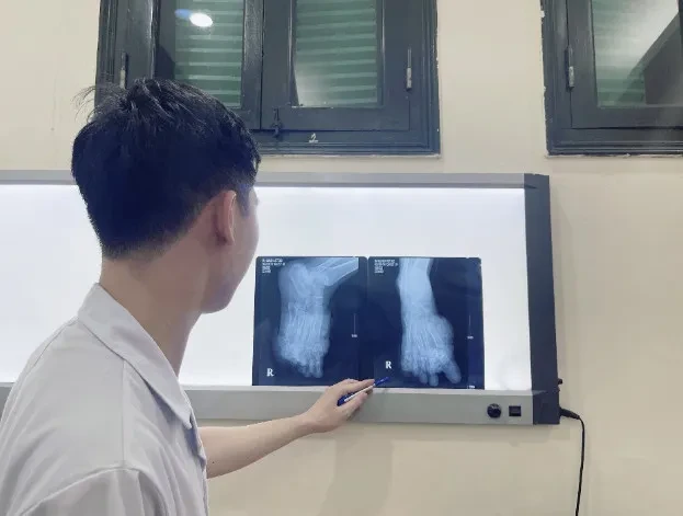 Cảnh báo chấn thương từ tai nạn lao động