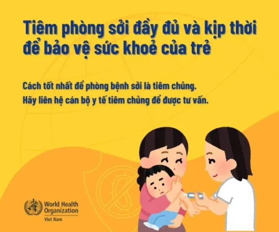 Những điều quan trọng các bậc phụ huynh cần biết về bệnh sởi