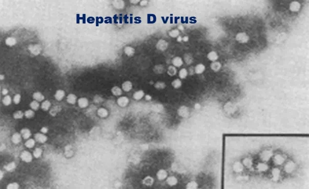 Xét nghiệm phát hiện nhiễm virus viêm gan D
