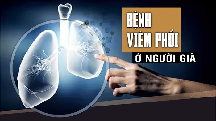 Bệnh viêm phổi ở người già